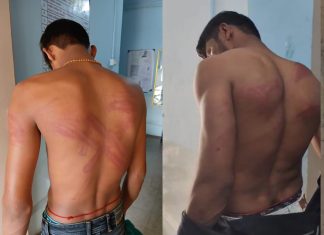 पाण्याच्या बाटली वरून झाला वाद,बार चालकाकडून जेवणासाठी आलेल्या गिऱ्हाईकाला अमानुष मारहाण